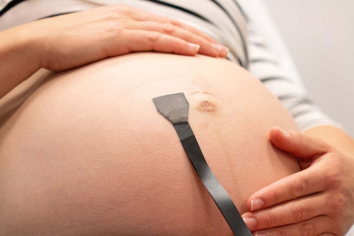 Soft, bendable ultrasound patch designed to monitor fetal health during pregnancy continuously