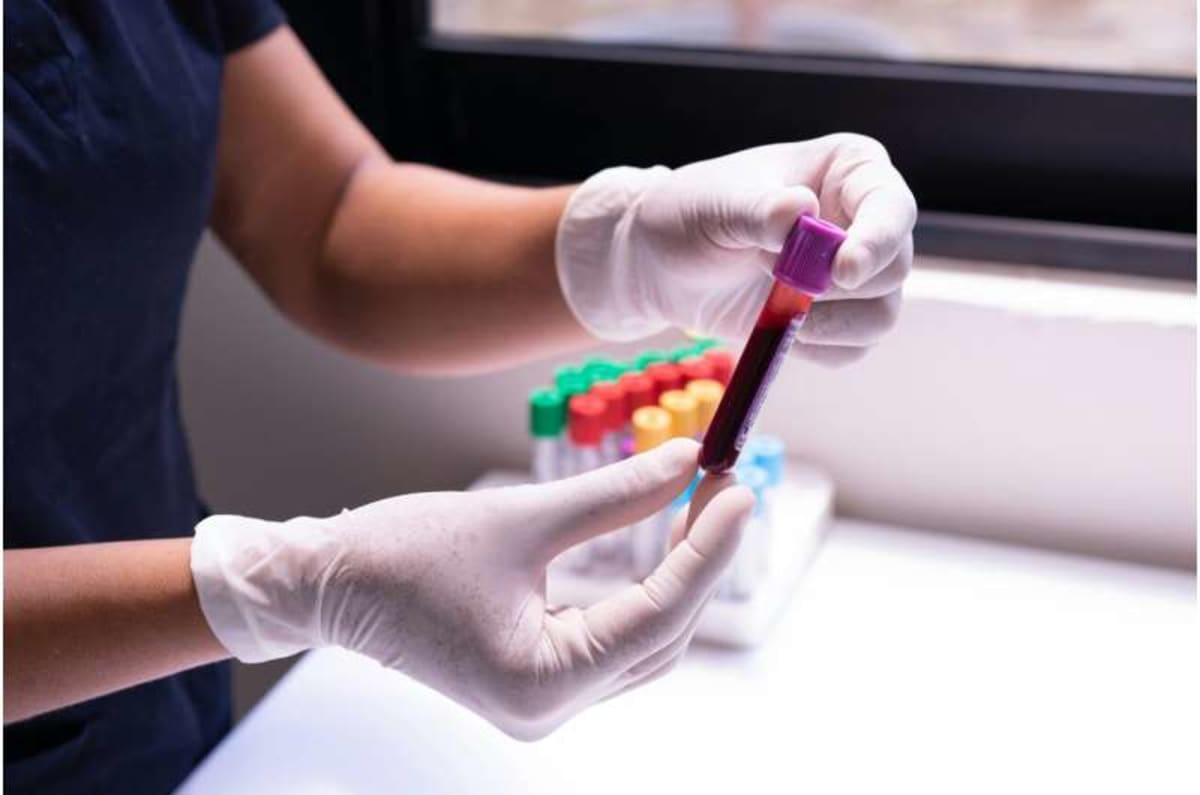 UCLA Blood Test Detects Multiple Cancers for Under $20 - Image 3