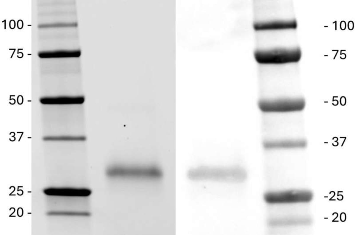 New Vaccine Cuts Wild Animal Fertility by 67% - Image 3