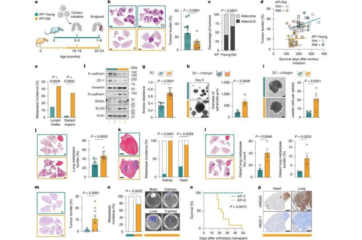 Scientists Find New Way to Stop Lung Cancer Spreading - Image 4