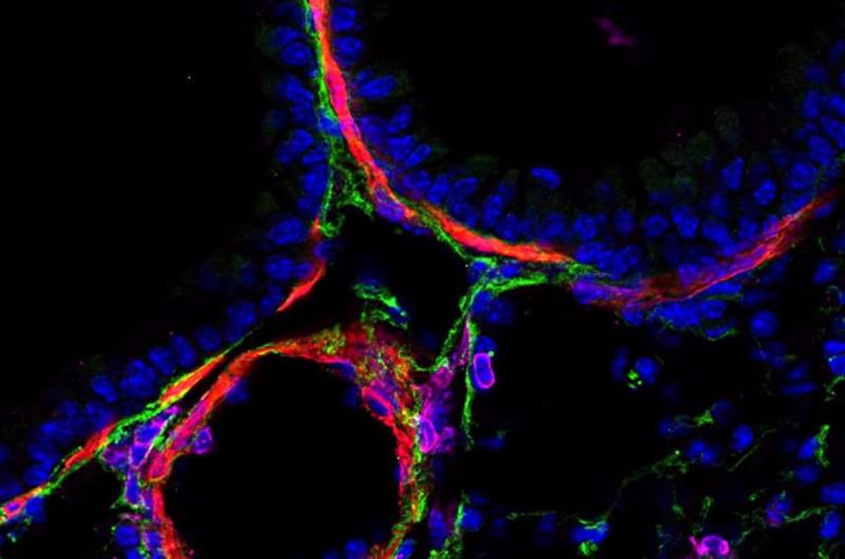Lung Cells Remember Microbes, Block Allergies for Months - Image 2