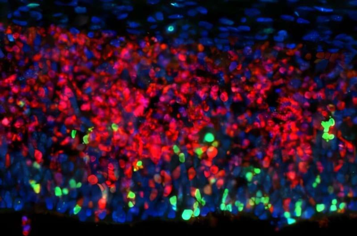 Scientists Find New Way to Fight Multiple Sclerosis - Image 3