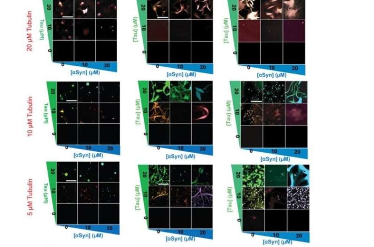 Brain Protein Tubulin Blocks Alzheimer's Toxic Clumps - Image 3