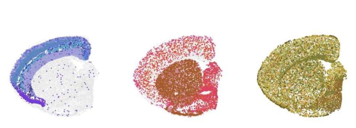 Scientists Map Brain Aging to Fight Dementia - Image 3