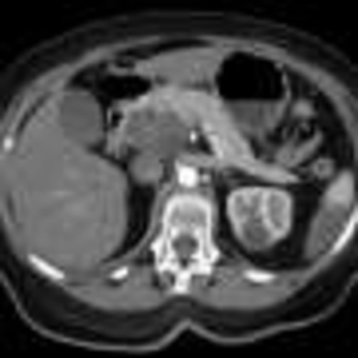 Gene Therapy Restores Hearing for Up to 2.5 Years - Image 4