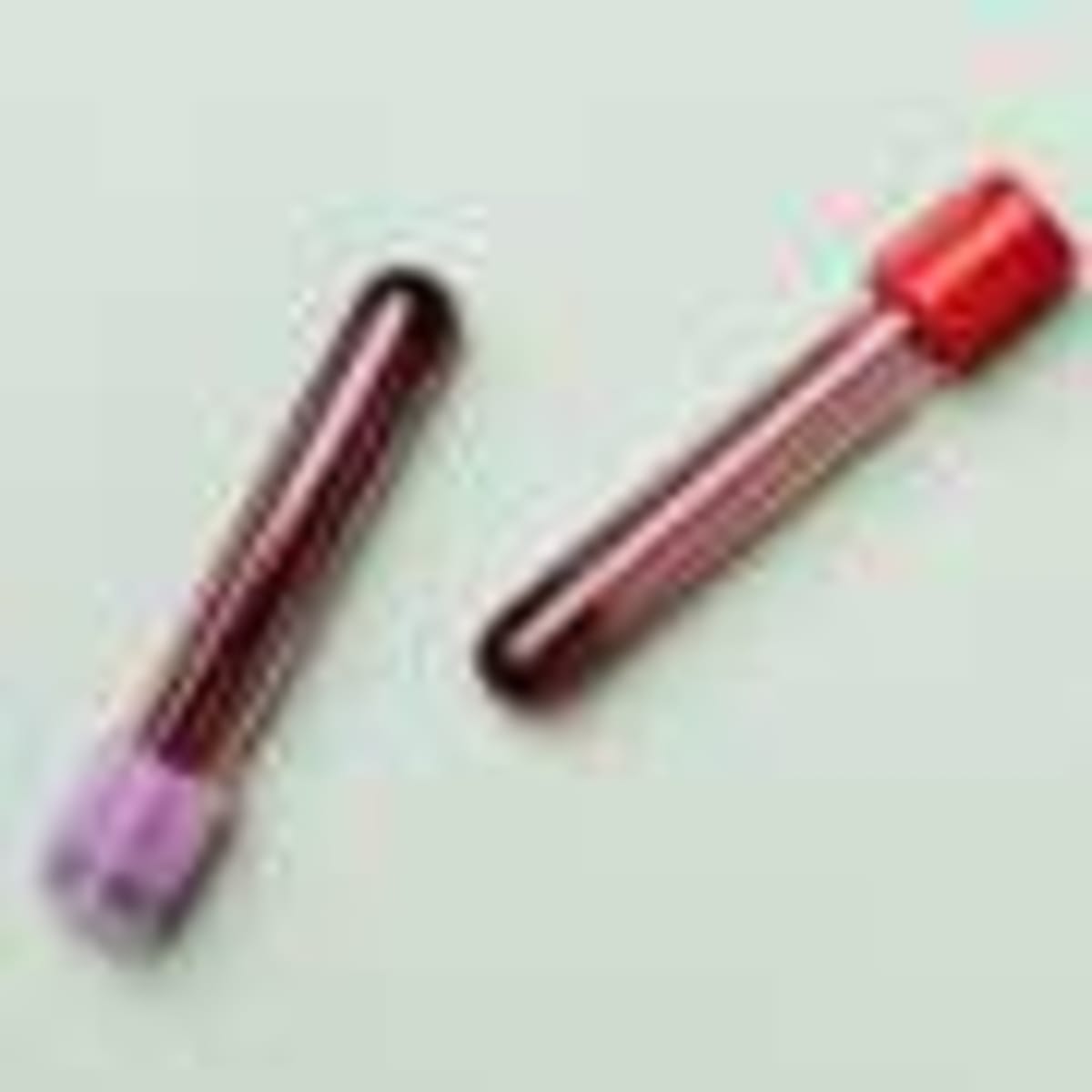 AI Predicts Which Bowel Cancer Patients Benefit From Drug - Image 4