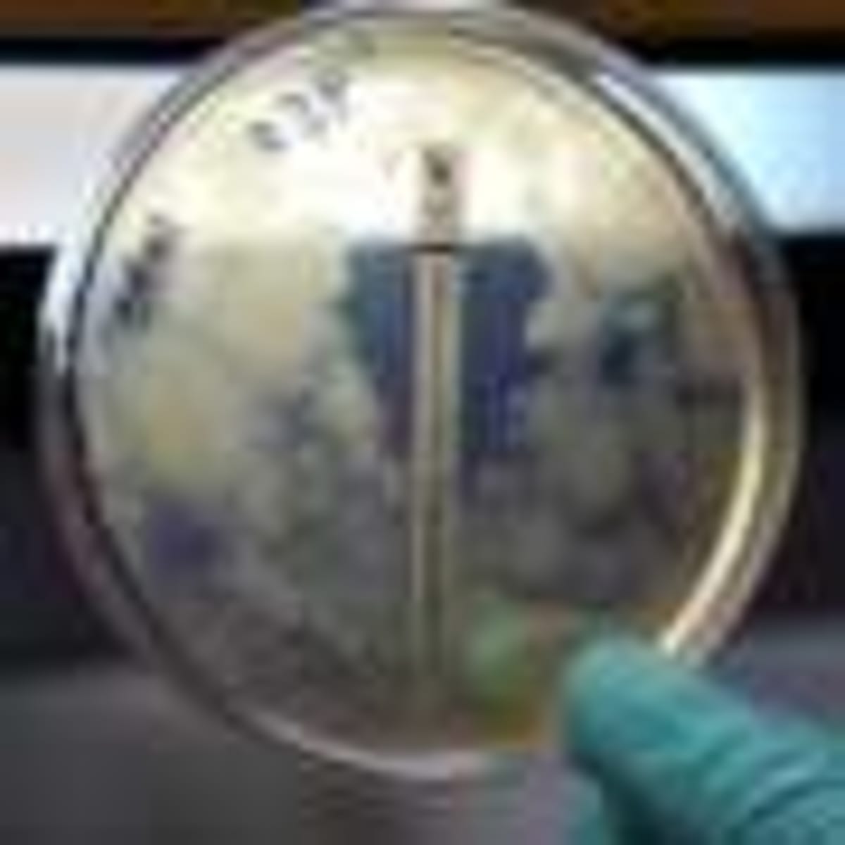 UCLA Finds Genetic Key to Personalized Weight Loss Drugs - Image 4