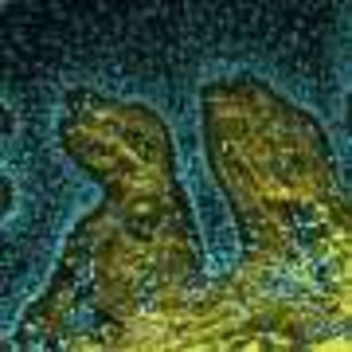 Scientists Find New Way to Fight Multiple Sclerosis - Image 5