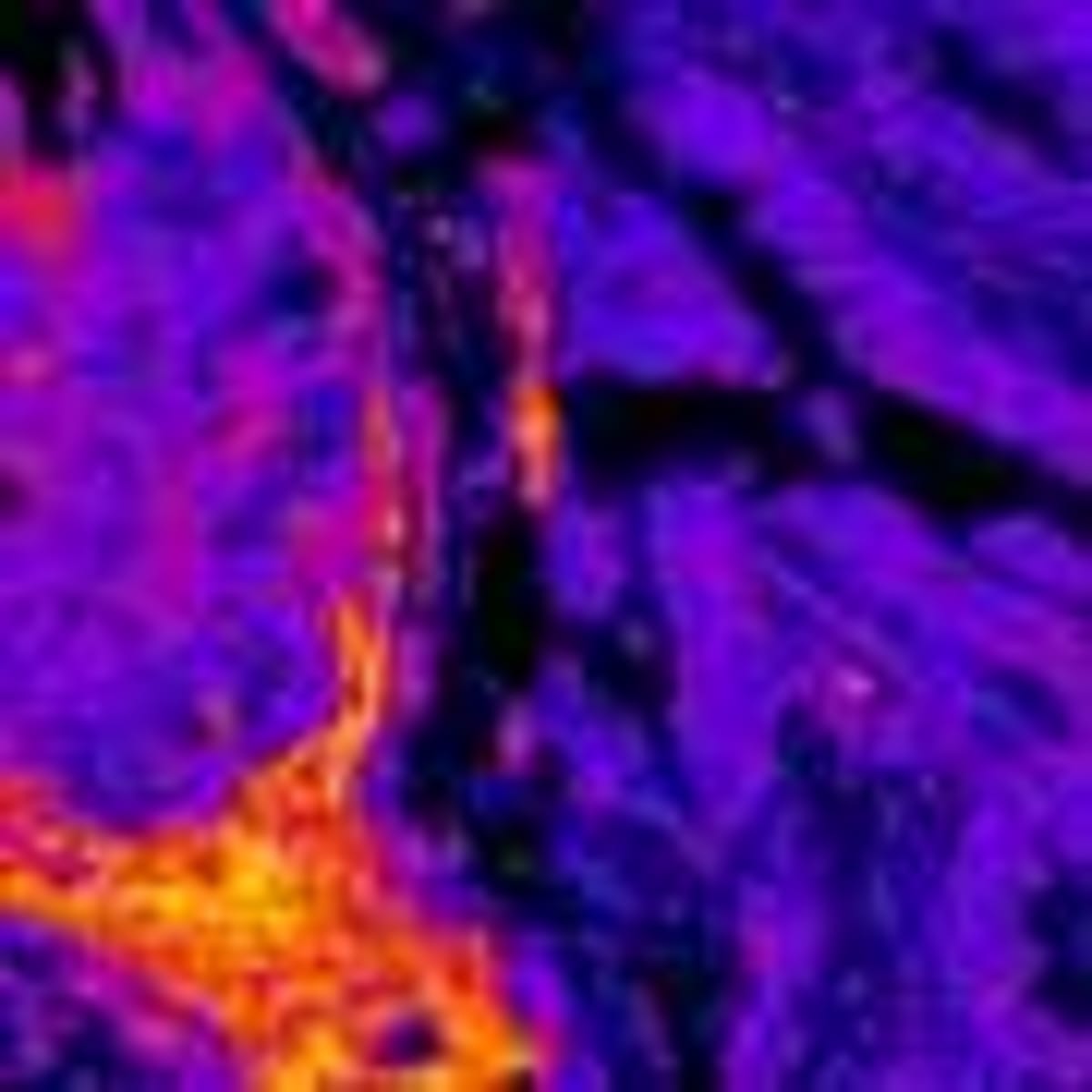 Japan Approves World's First Stem Cell Treatment - Image 4