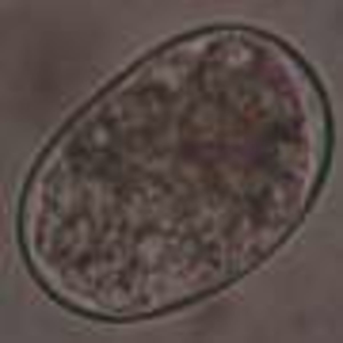 Scientists Find New Way to Fight Drug-Resistant TB - Image 5