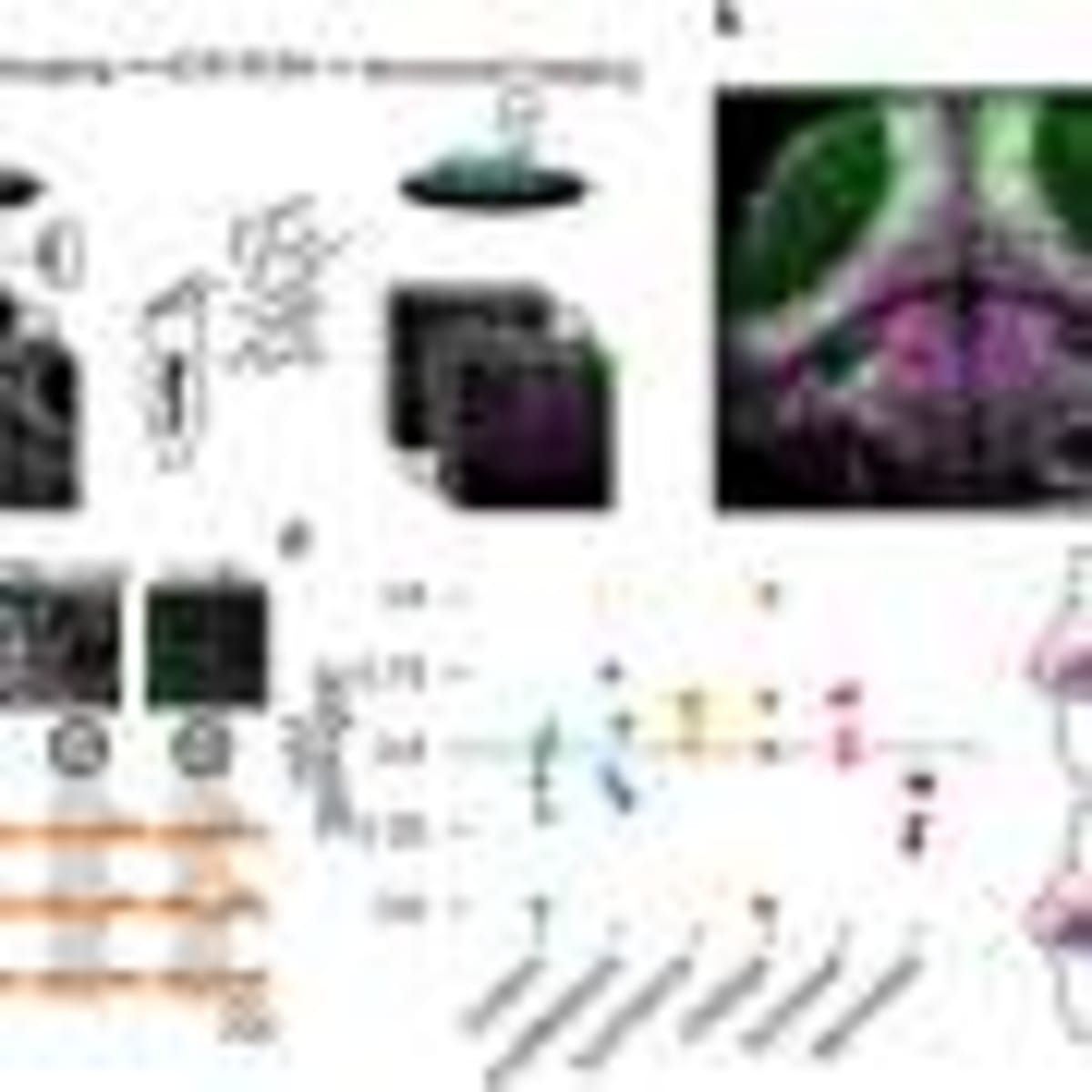 New Leukemia Treatment Boosts Remission Rates to 75% - Image 5