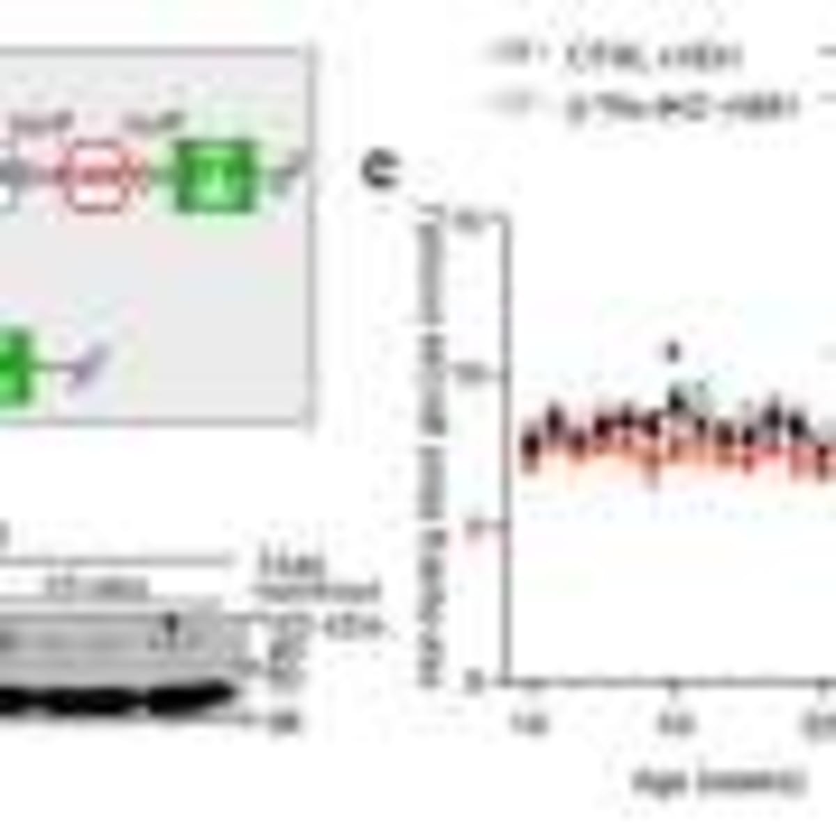 Joan Riggs' Shaky Hands Steady After New Brain Treatment - Image 3