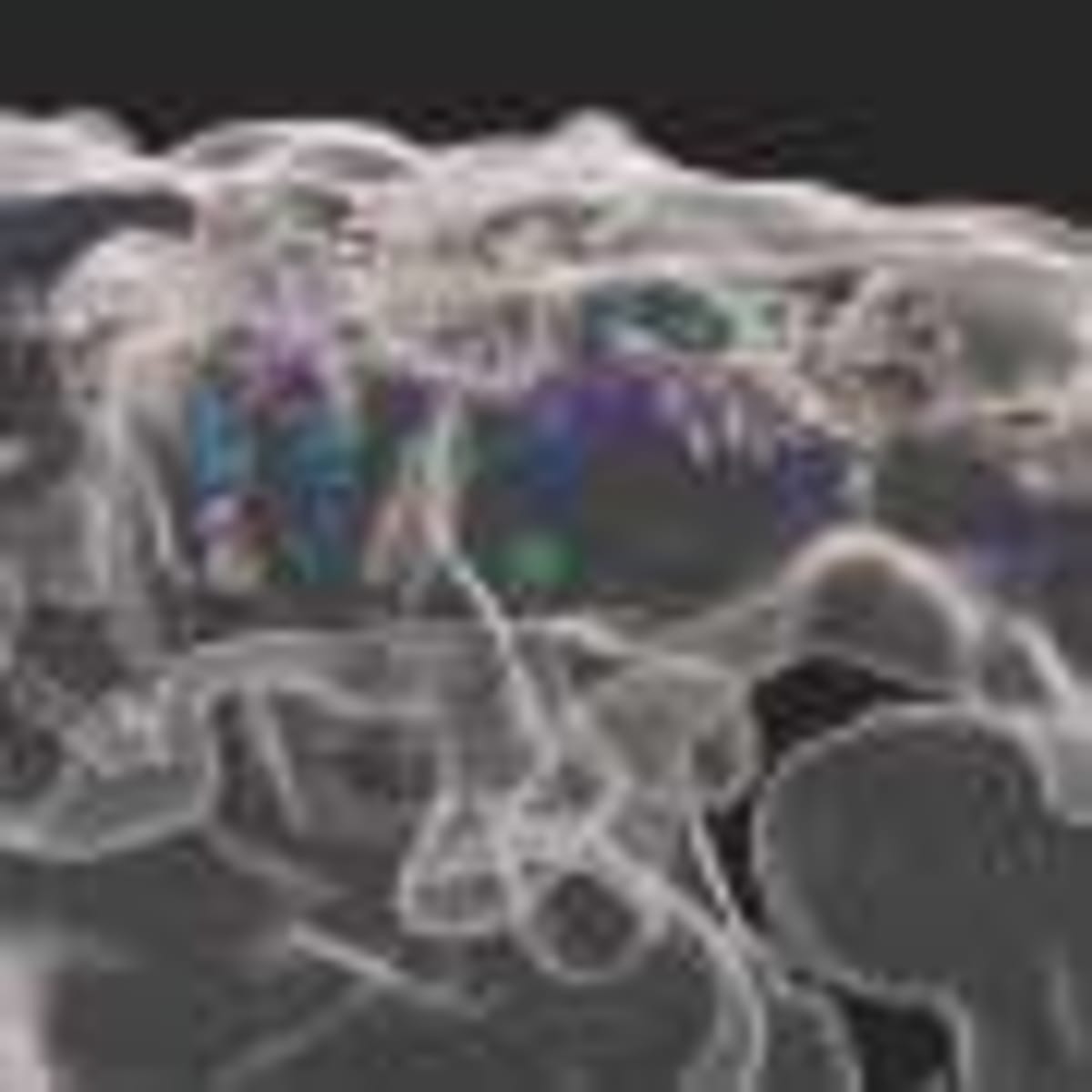 Scientists Find New Way to Fight Drug-Resistant TB - Image 4