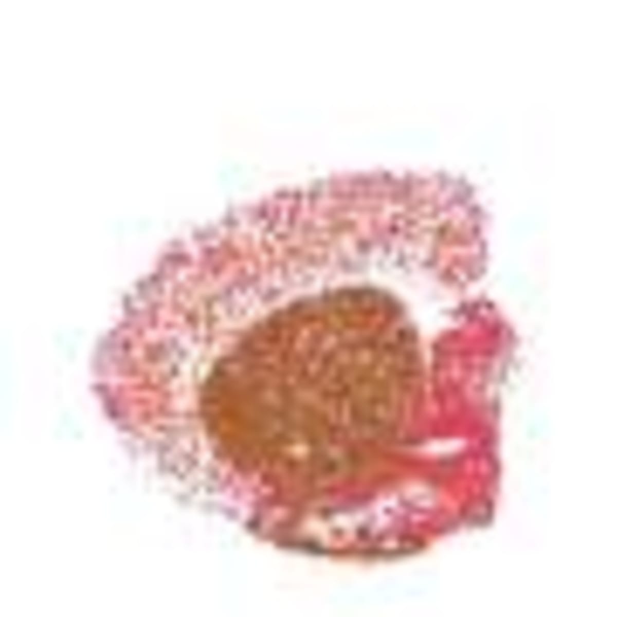 New Tool Predicts Health Risks in Young Psychosis Patients - Image 5