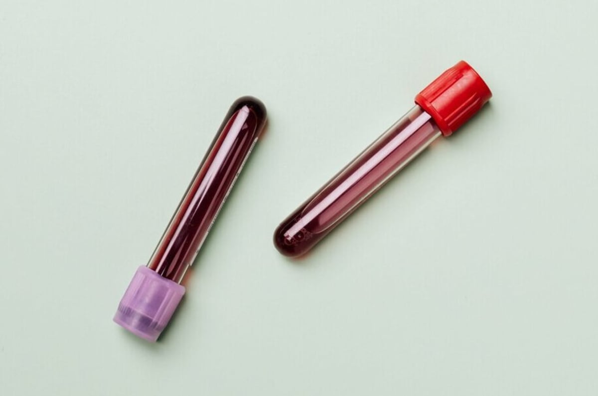 Blood Test Predicts Testicular Cancer Relapse Early - Image 2
