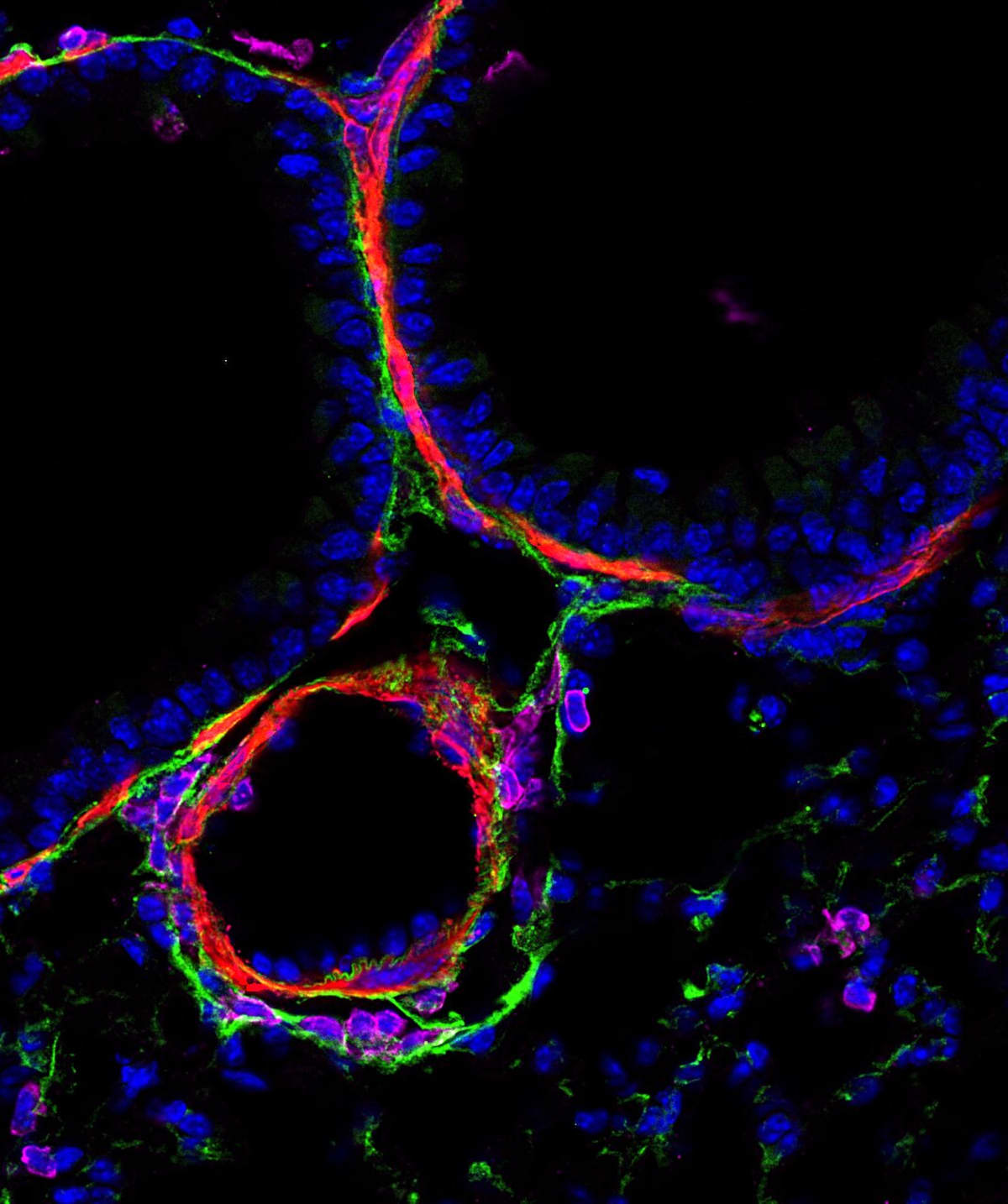 Lung Cells Remember Microbes, Block Allergies for Months