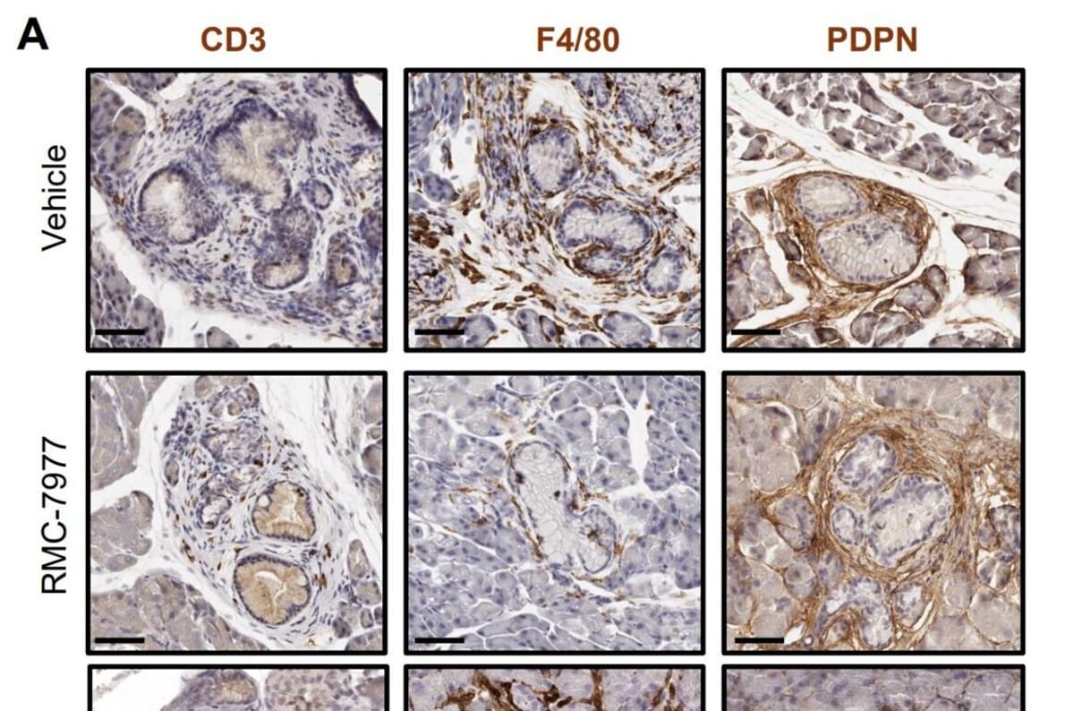 Scientists Stop Pancreatic Cancer Before It Starts in Mice - Image 2