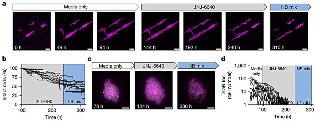Scientists Find New Way to Fight Drug-Resistant TB