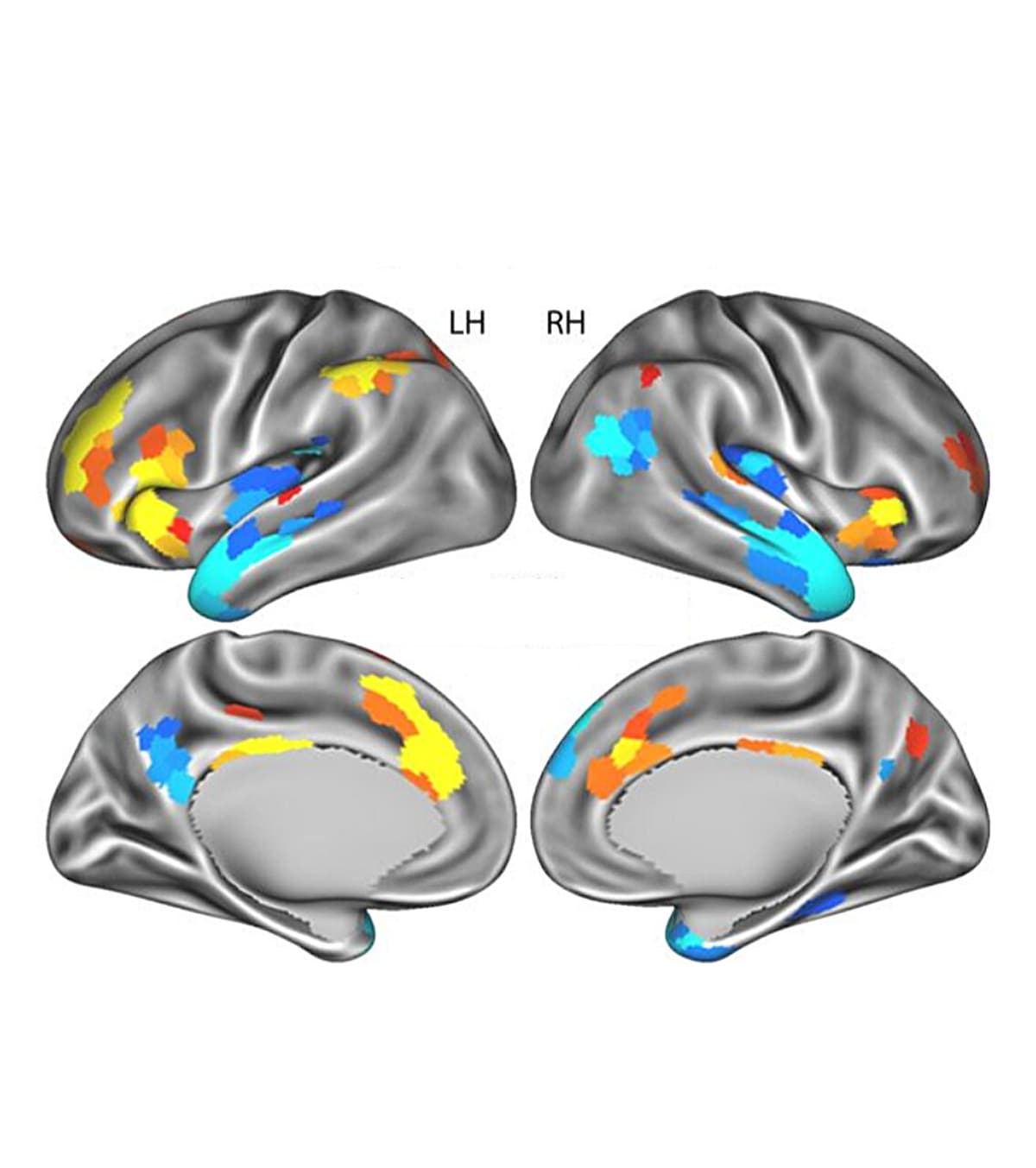 Brain Study Could Transform Hearing Aids for Noisy Spaces