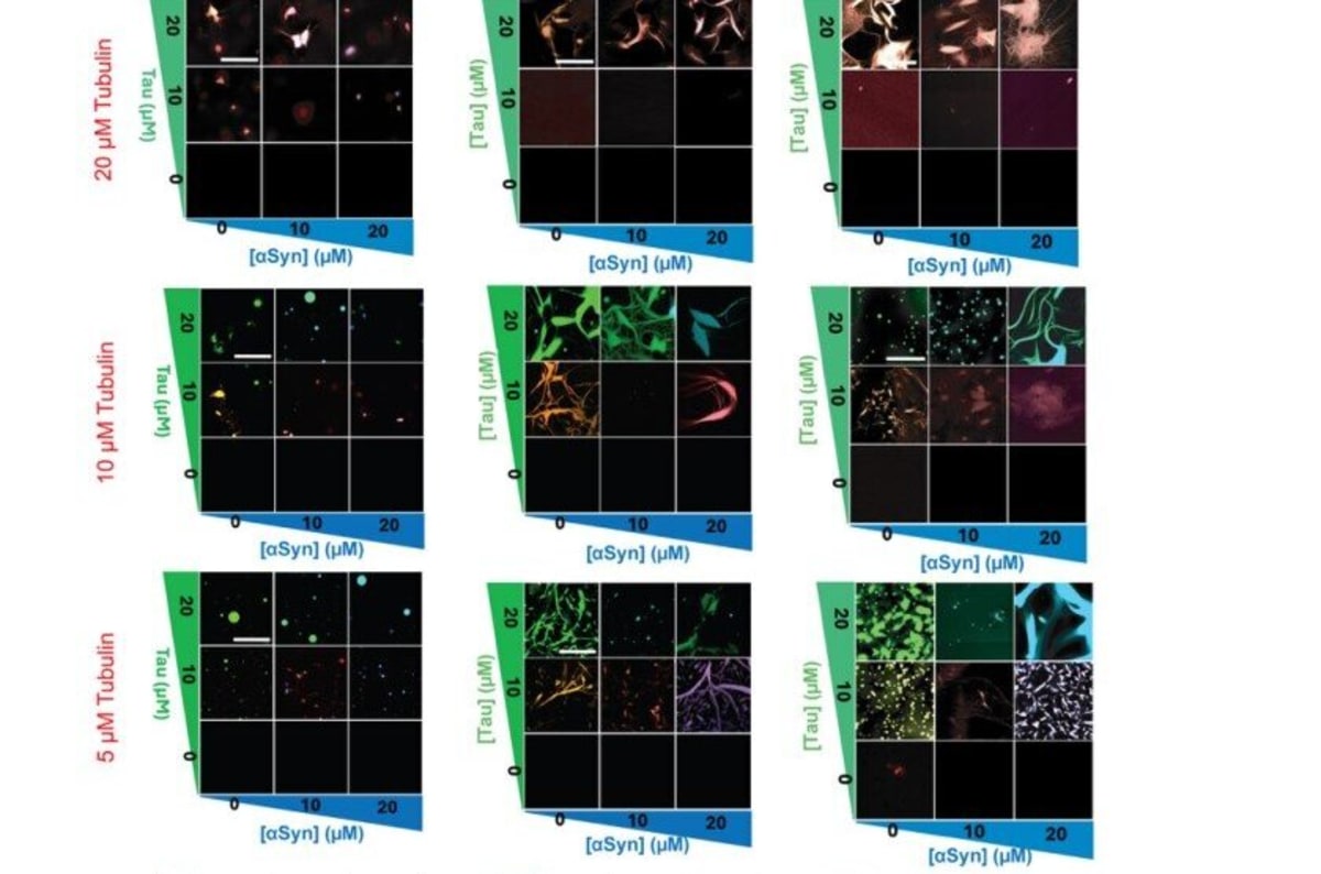 Brain Protein Tubulin Blocks Alzheimer's Toxic Clumps - Image 2