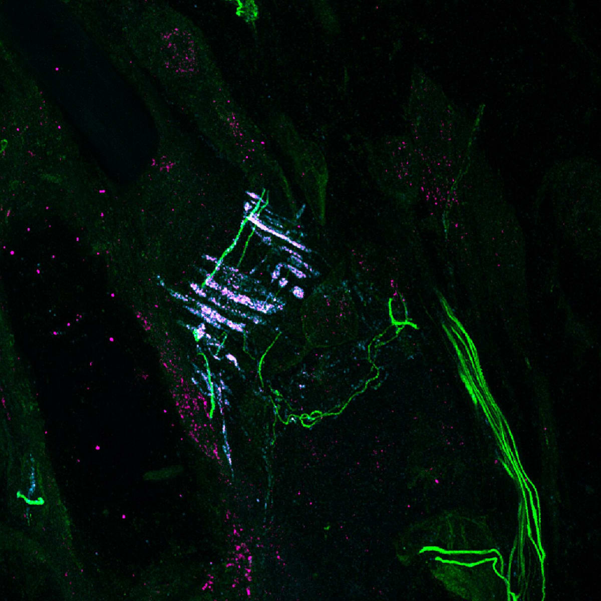 Microscopy image showing cyan PIEZO2 protein and magenta filamin-B around hair follicle nerve endings