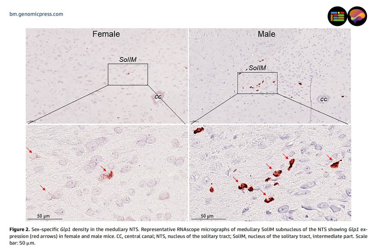 Scientists Map Brain Differences in Weight-Loss Drug Effects