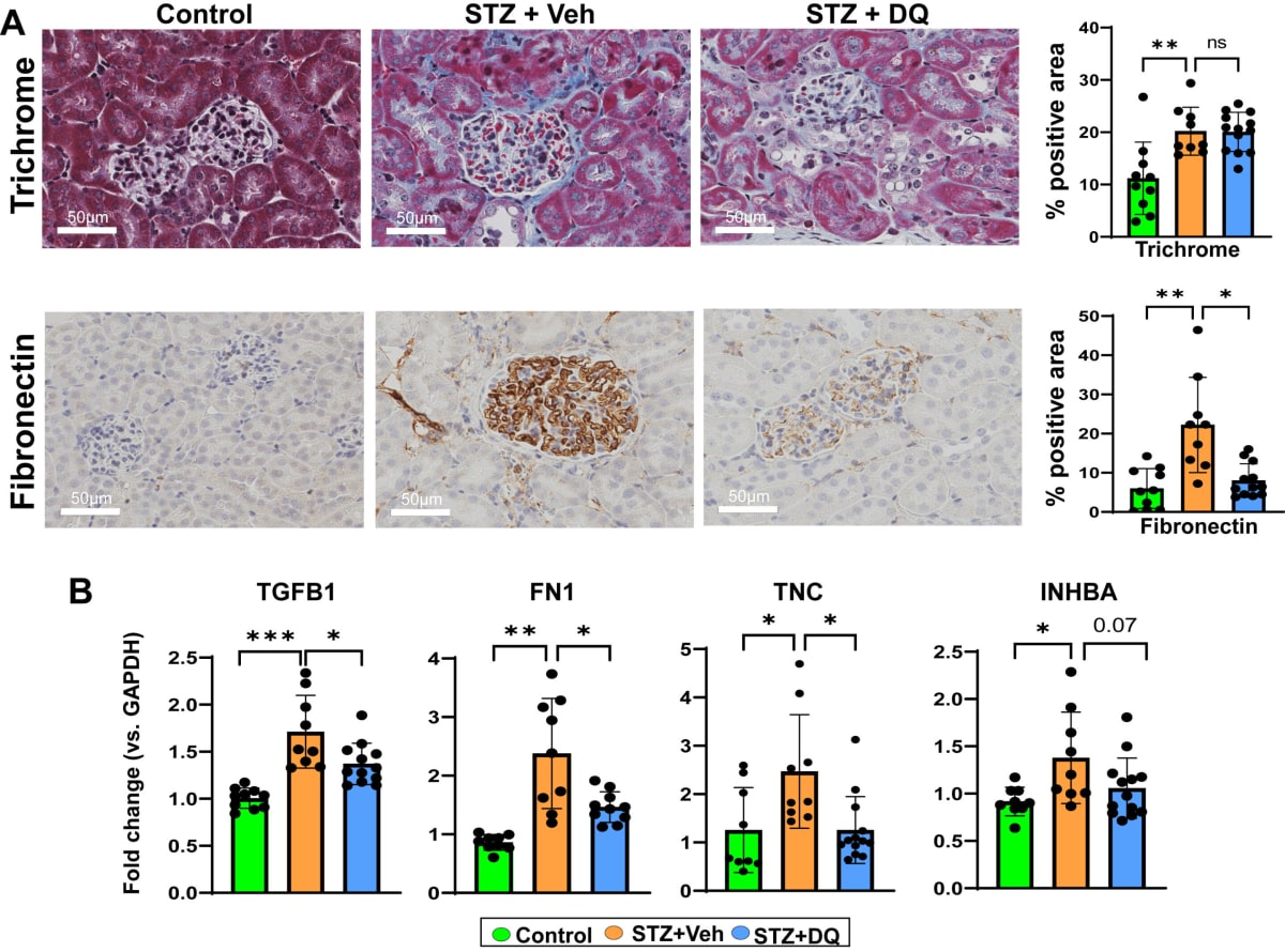 Microscope image showing kidney tissue with reduced inflammation after senolytic treatment