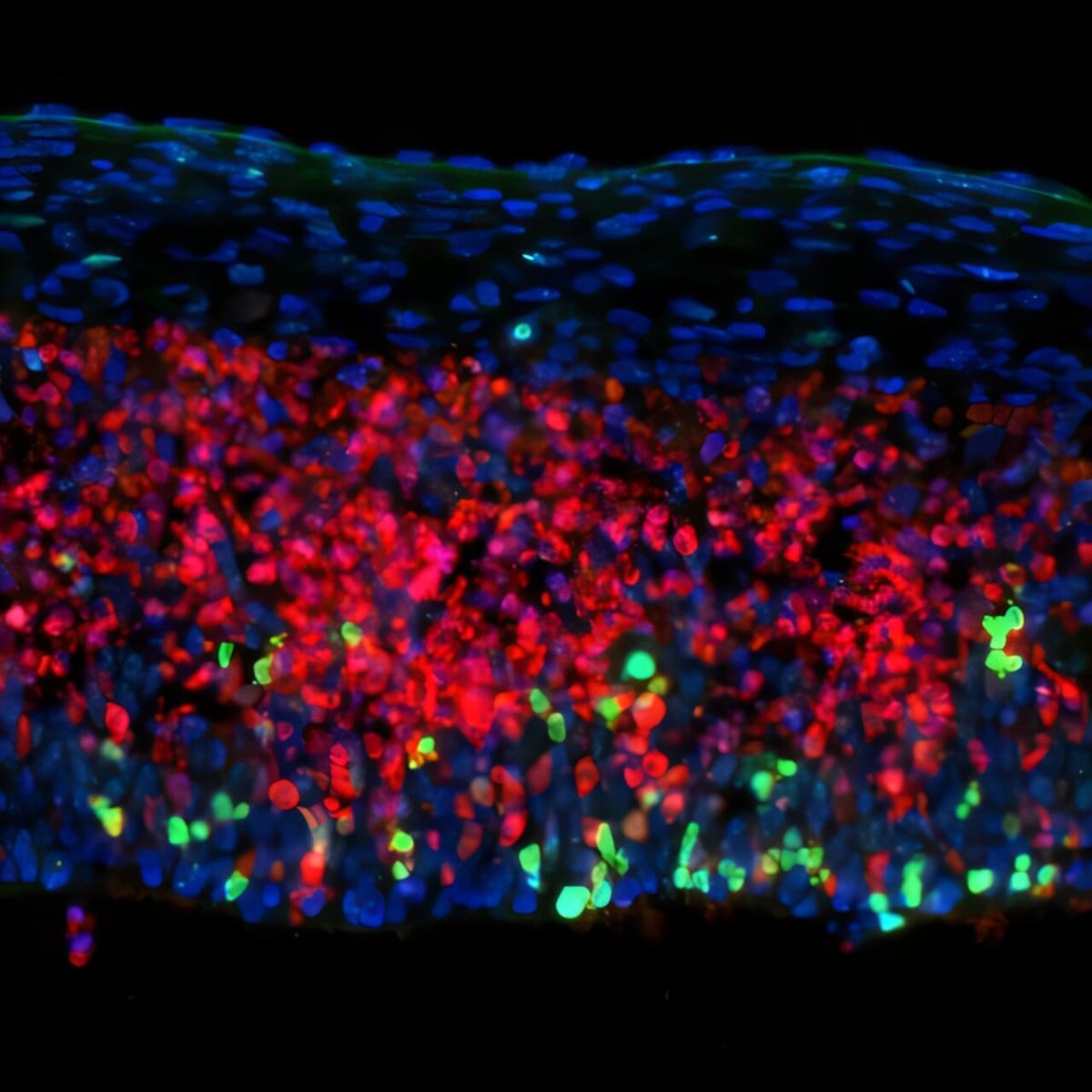 Scientists Find New Way to Fight Multiple Sclerosis