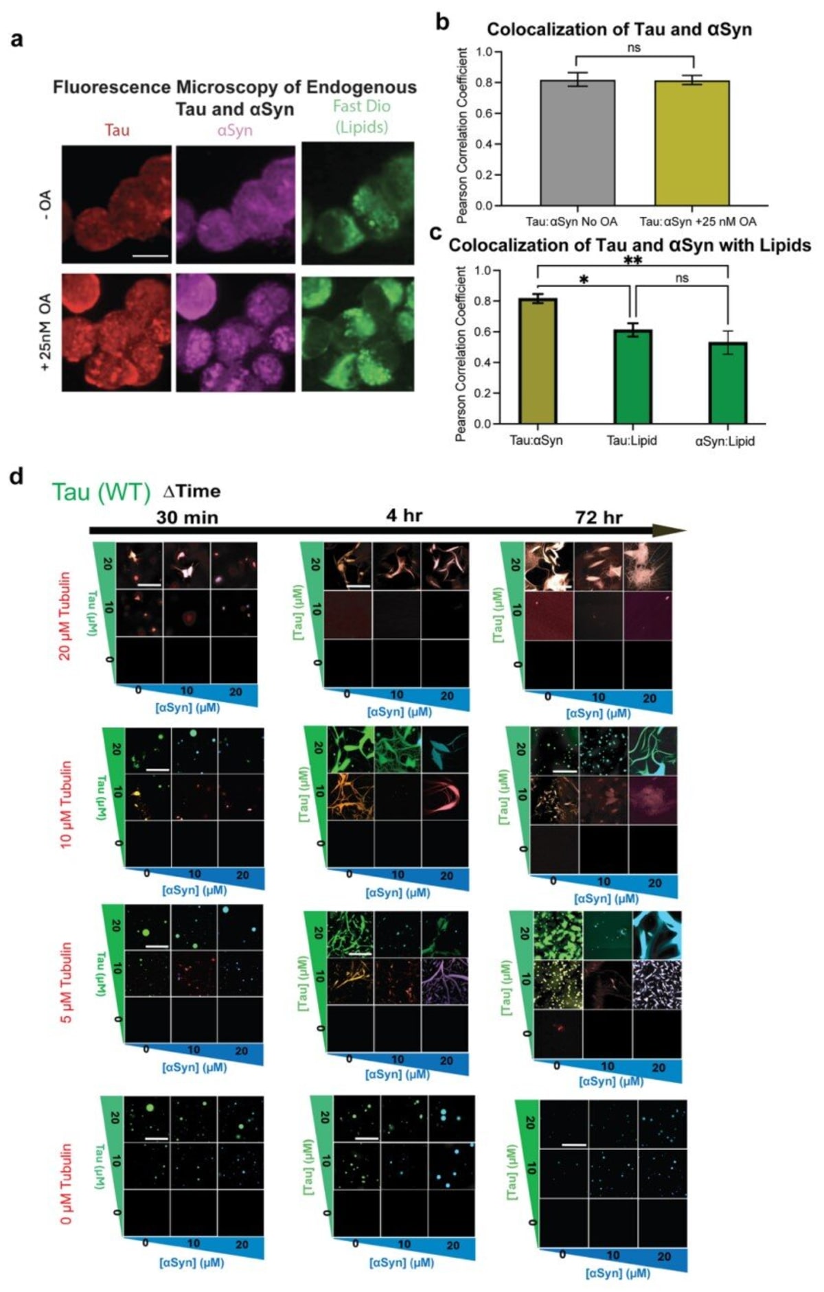 Brain Protein Tubulin Blocks Alzheimer's Toxic Clumps