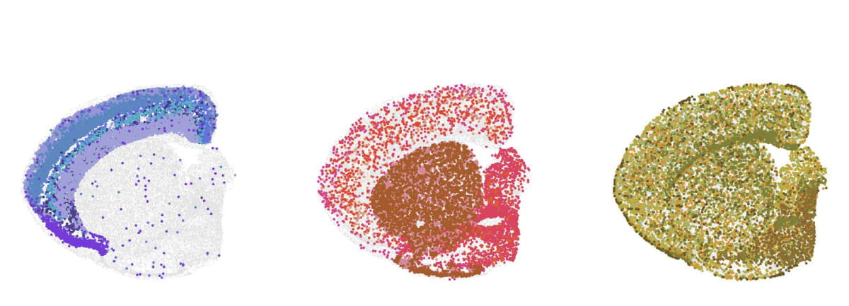 Scientists Map Brain Aging to Fight Dementia