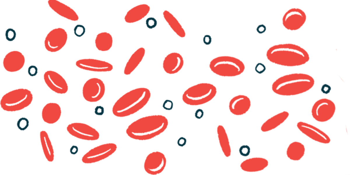 Johns Hopkins Stem Cell Treatment Cures 95% of Sickle Cell