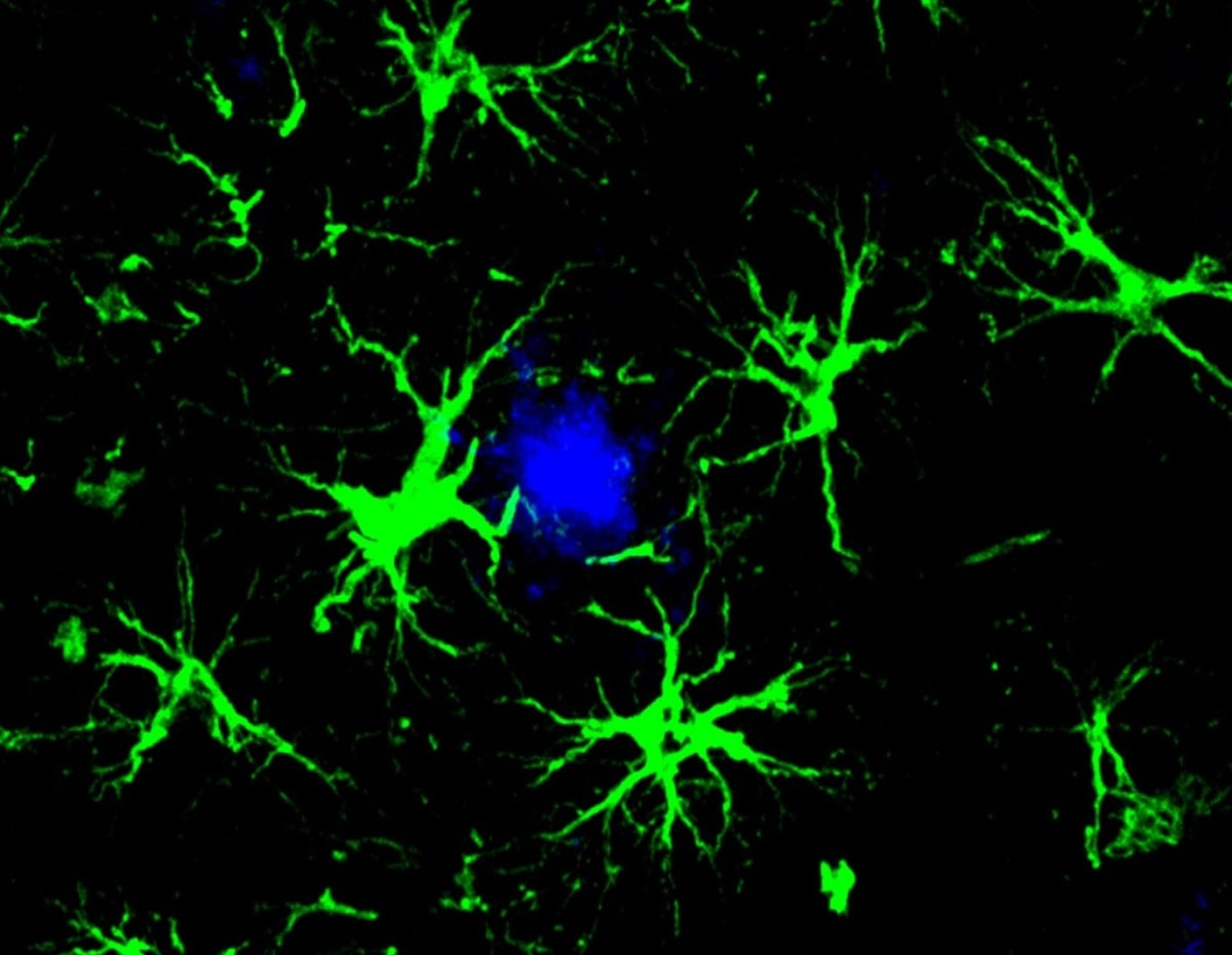 Brain Cells Engineered to Eat Alzheimer's Plaques in Mice