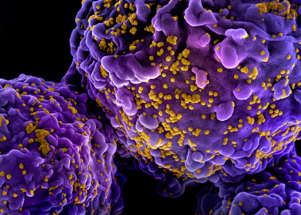 Cancer Therapy Brings Hope to Autoimmune Disease Patients - Image 4