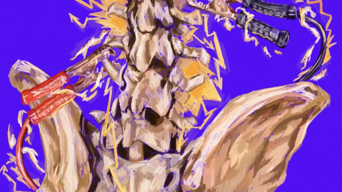 Medical illustration showing spinal cord implant electrode arrays delivering electrical stimulation to paralyzed patient