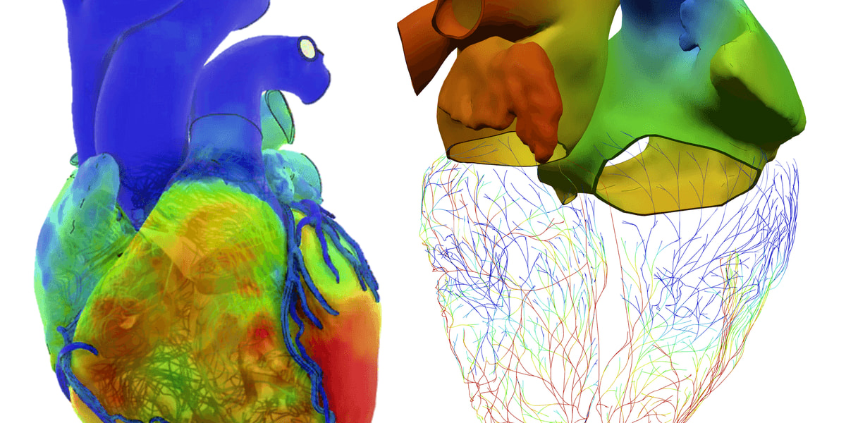 Virtual Heart Models Save Lives at Boston Children's Hospital