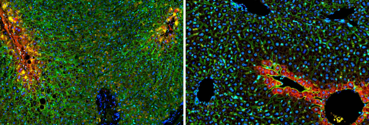 Microscopic image showing glucose transporter protein zones in human liver tissue with colored cells