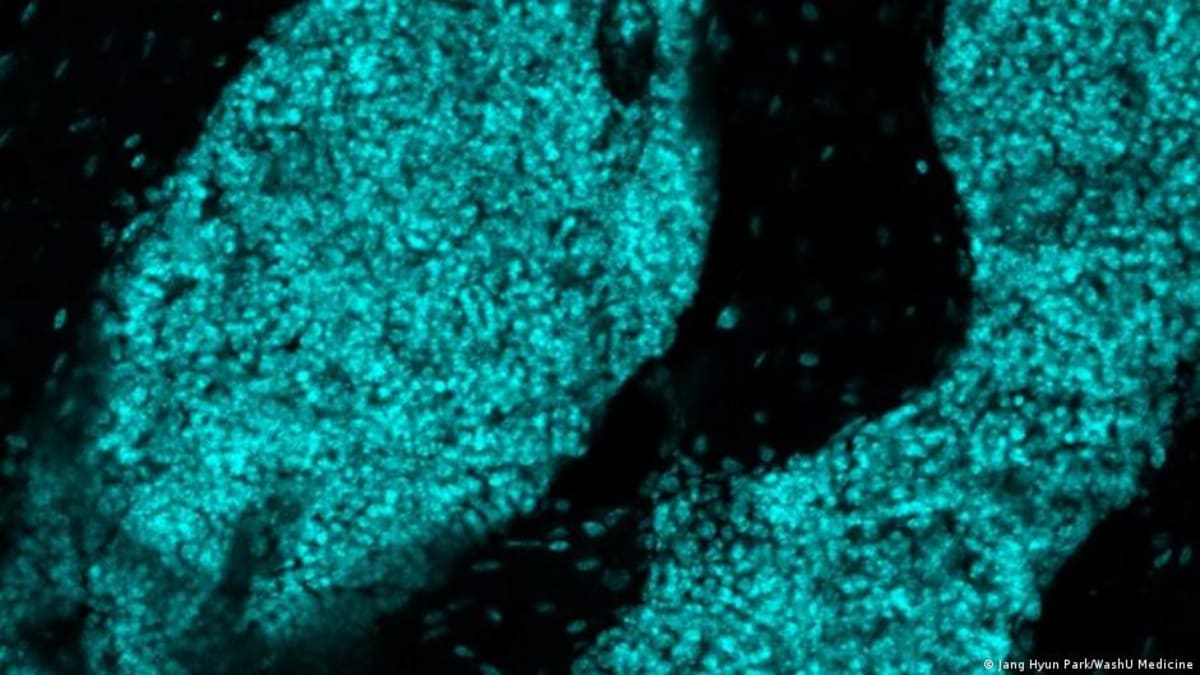 Scientists Find Immune Defense Centers in Skull Bone