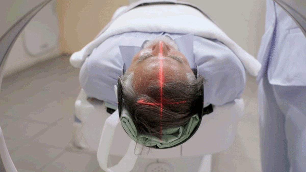 Longevity Gene' Boosts Brain's DNA Repair Against Alzheimer's