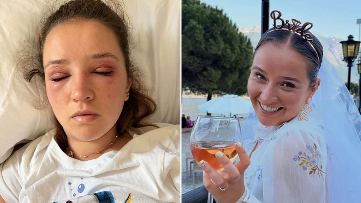 Bride's Eyelash Disaster Saves Others From Same Fate
