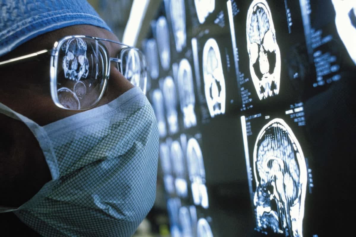 Blood Test Detects Brain Tumors with 90% Accuracy