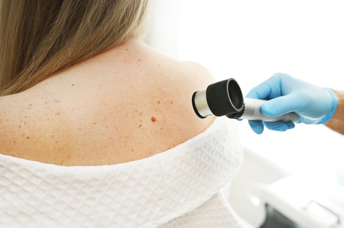 Personalized Cancer Vaccine Stops Melanoma From Returning - Image 2