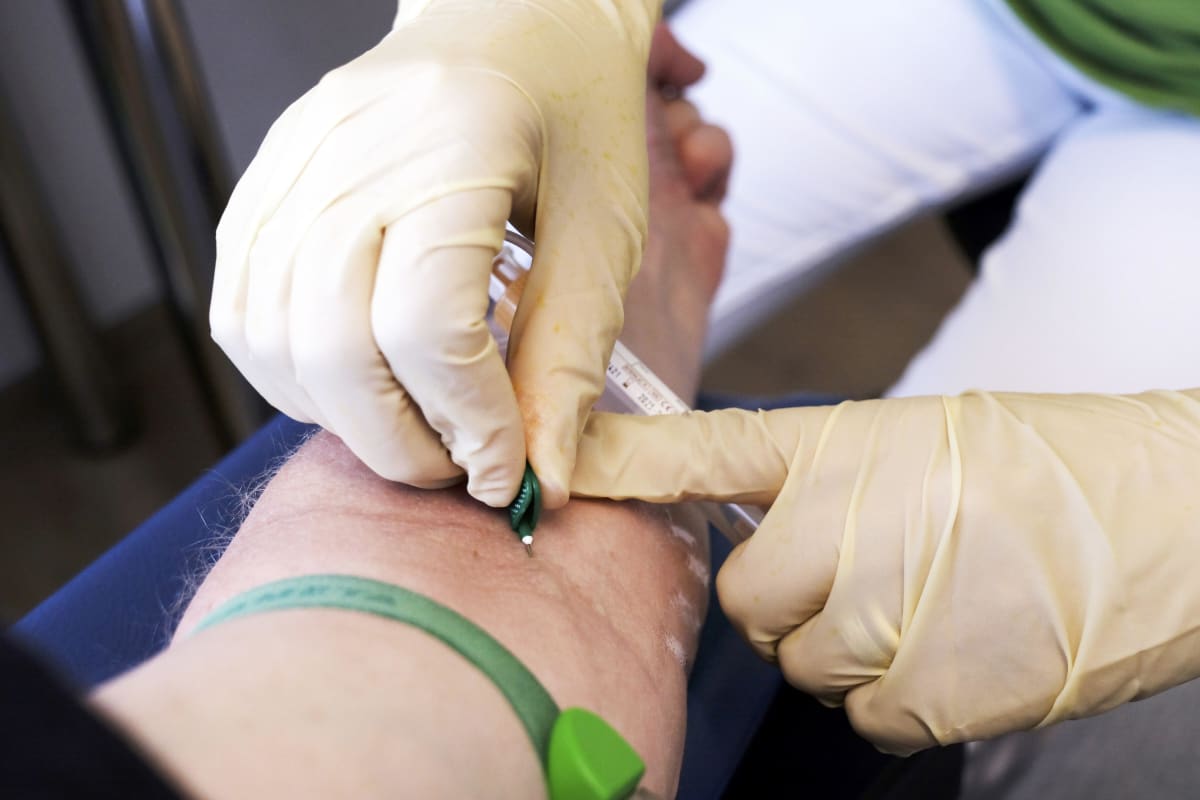 Blood Test Detects Brain Tumors with 90% Accuracy - Image 2