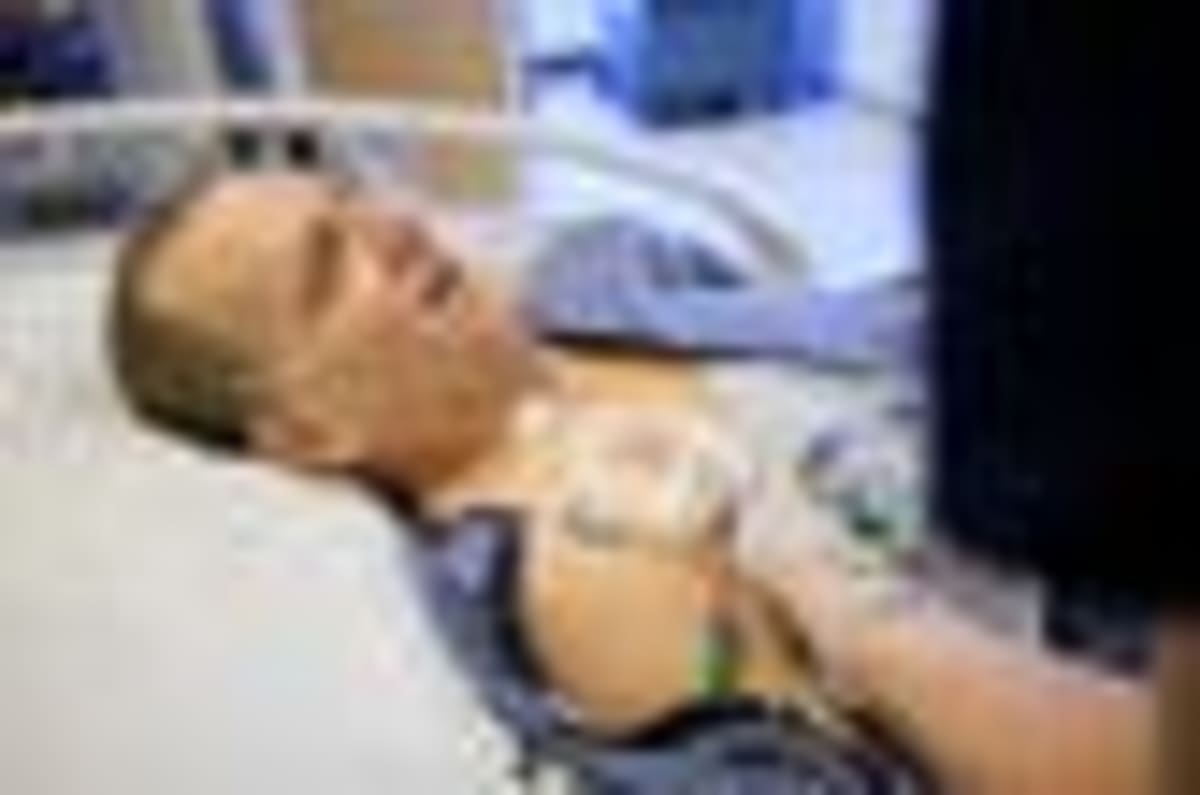 Man Lives 9 Months With Pig Kidney in Medical First - Image 2