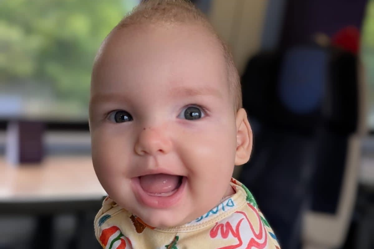 Toddler Gets World-First Surgery With Super Elastic Springs