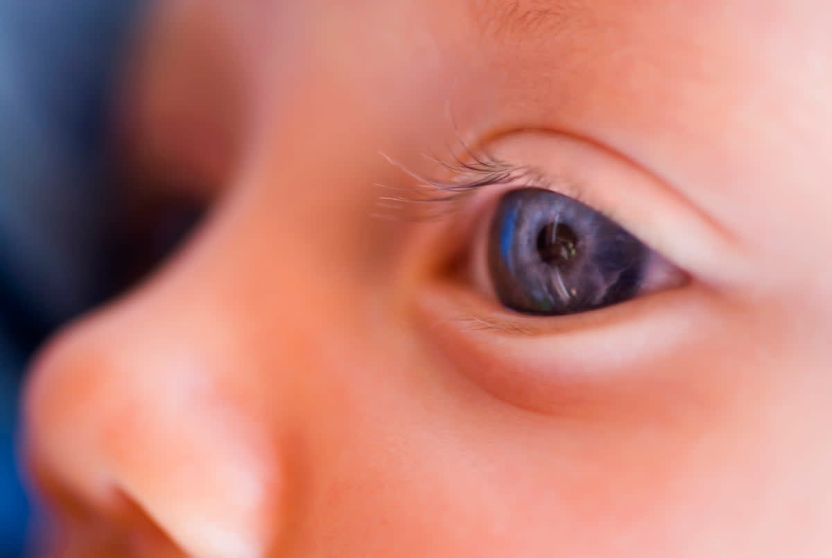 Gene Therapy Gives 500 Blind Patients Their Sight Back