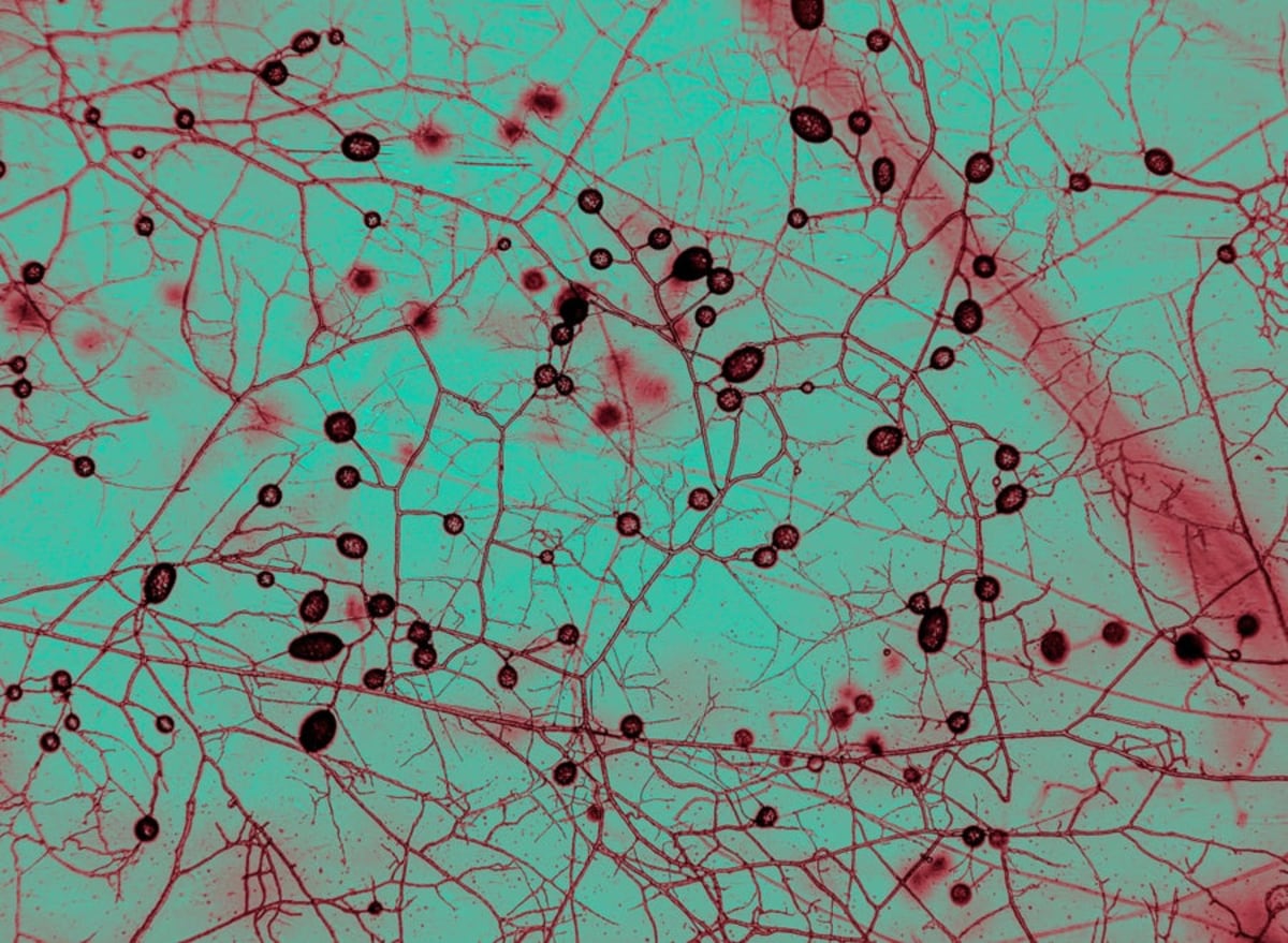 Hidden Fungal Network Could Stretch to Nearest Star - Image 3