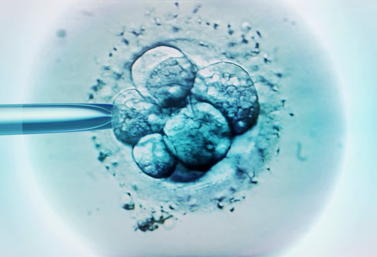 Microscope view of embryo selection process using artificial intelligence technology in IVF laboratory