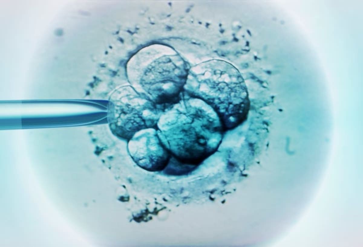 AI Boosts IVF Success Prediction from 51% to 81% - Image 2