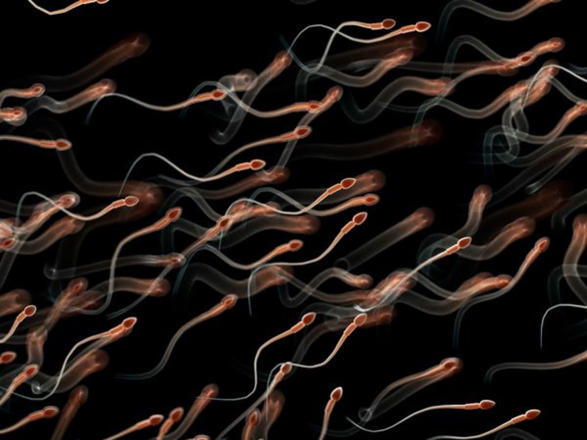 Sperm DNA Testing May End Repeat Miscarriage Mystery - Image 2