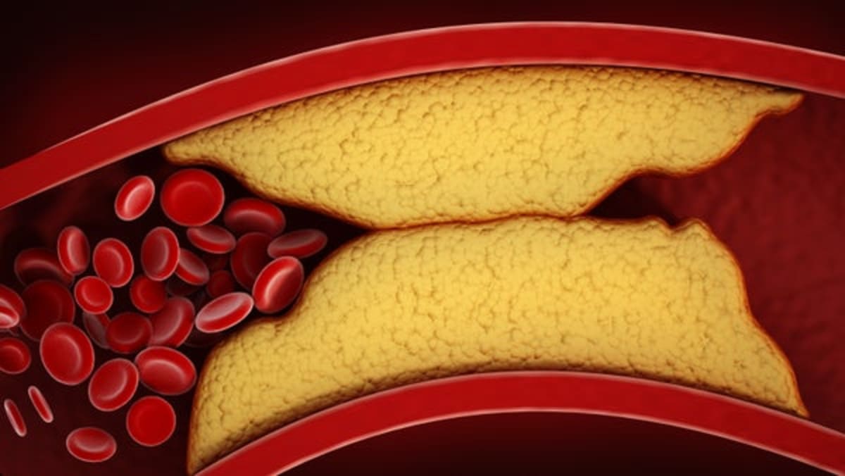 New Cholesterol Pill Slashes Levels by 60% at $10 Per Day - Image 2